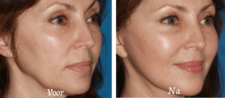 kaaklinjn dreamclinics